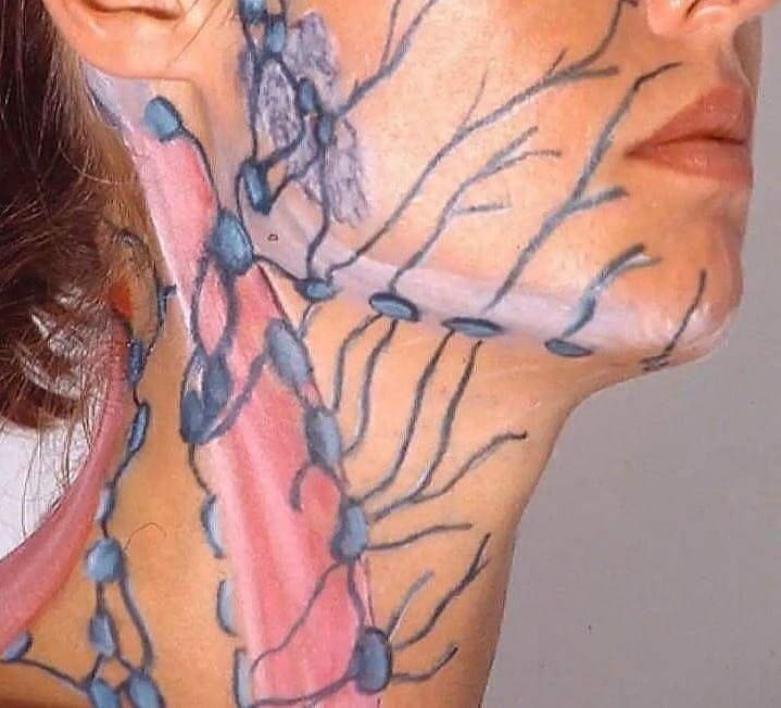 Χαρτογράφηση Λεμφαδένων Τραχήλου